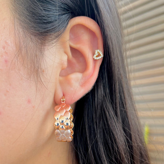 Aretes Velia